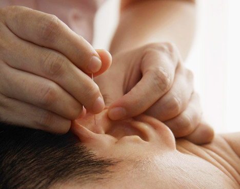 ART_accupuncture_03242011