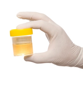 urinedrugtest-public2