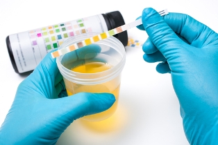 urine sample