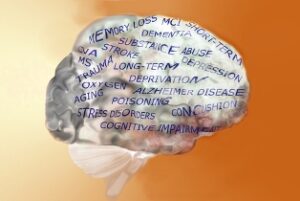 brain atrophy concept