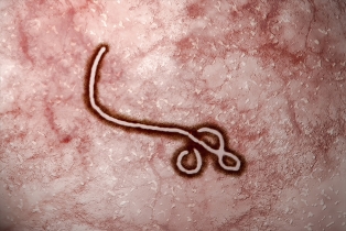 ebola up close
