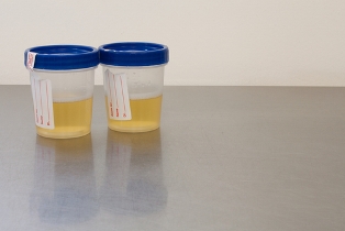 urine samples