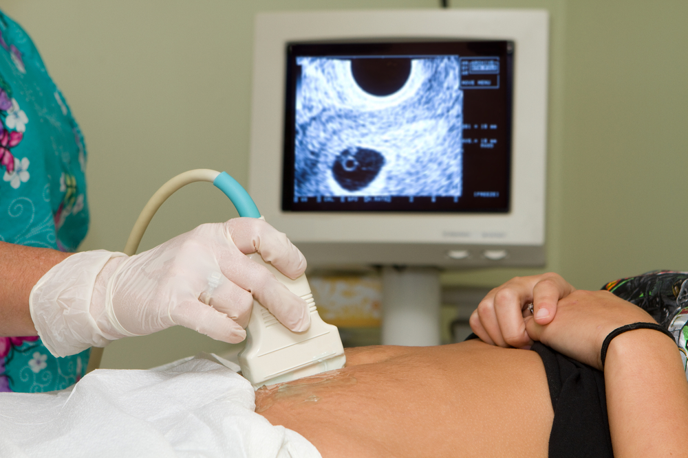 ultrasound