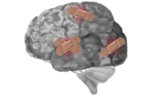 brain band-aids