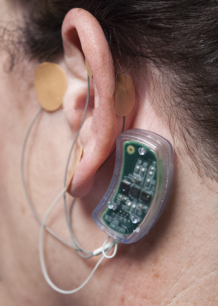 Could This New Device Offer Pain-Free Heroin and Opioid Withdrawal? Could This New Device Offer Pain-Free Heroin and Opioid Withdrawal?