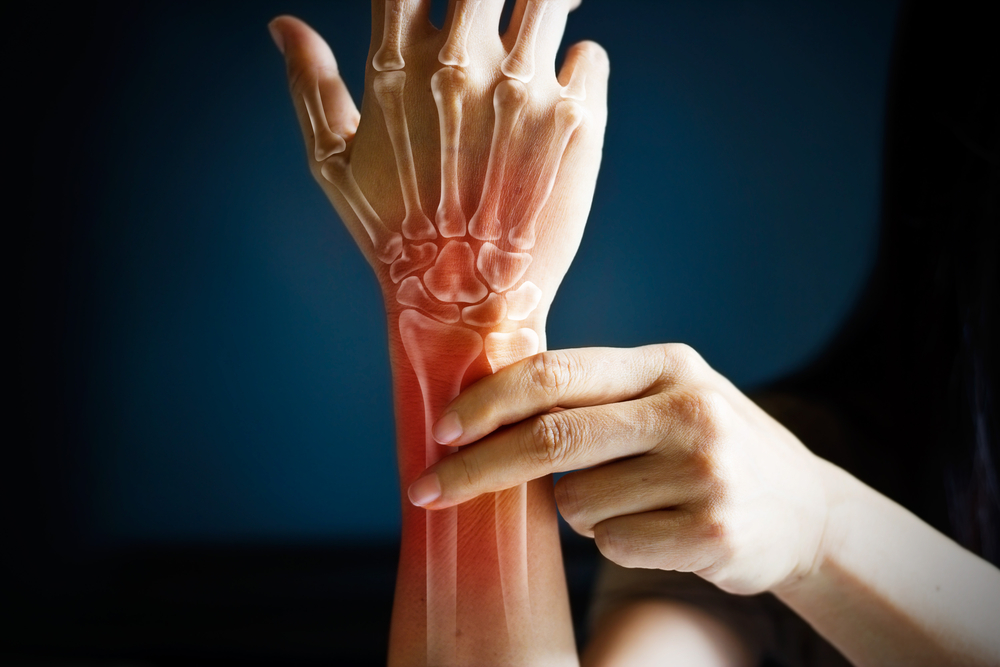 A hand with bones and redness indicating pain.