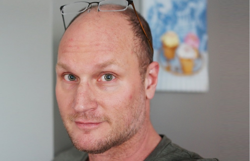 Author Augusten Borroughs