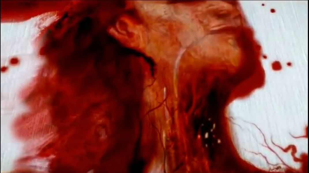 Red wine spill resembling an anatomical drawing in a PSA about alcohol use.