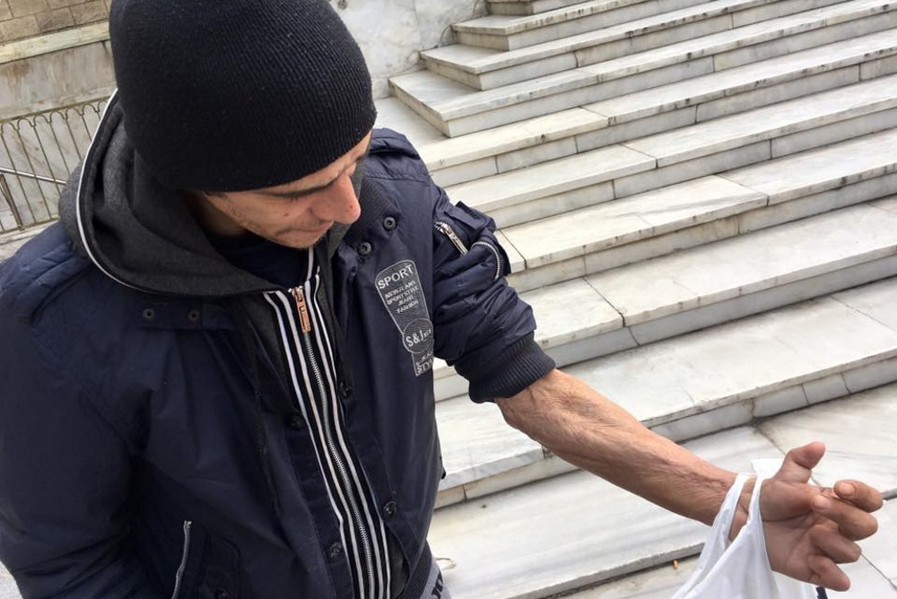 Man showing badly damaged arm