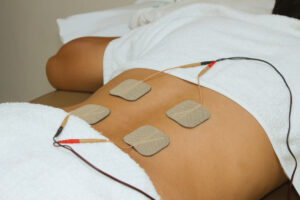 Patient with electrical stimulation therapy ( TENS ) on his back