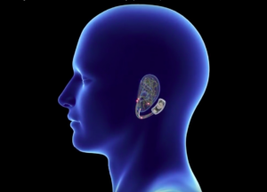 A rendering of the NSS-2 Bridge device