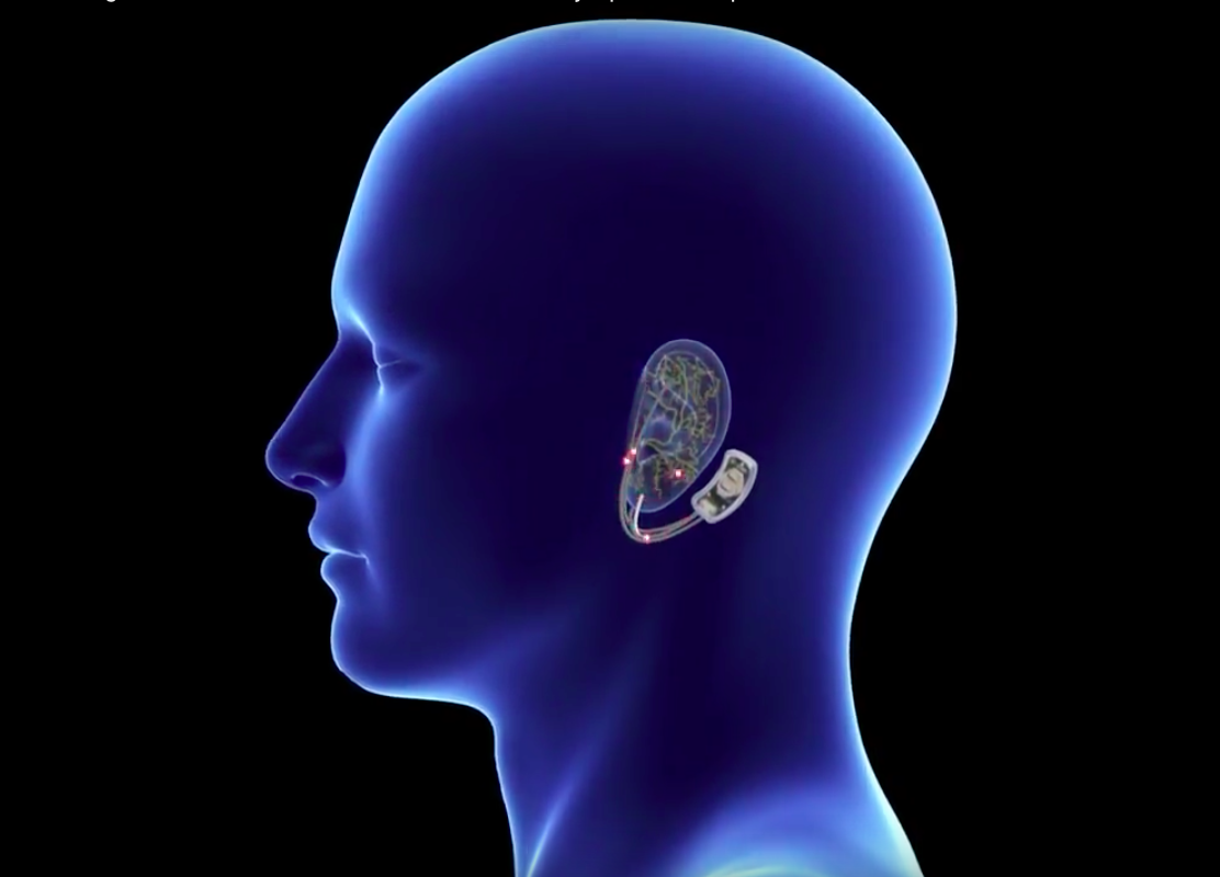 A rendering of the NSS-2 Bridge device