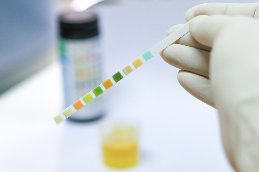 Medical report and urine test strips