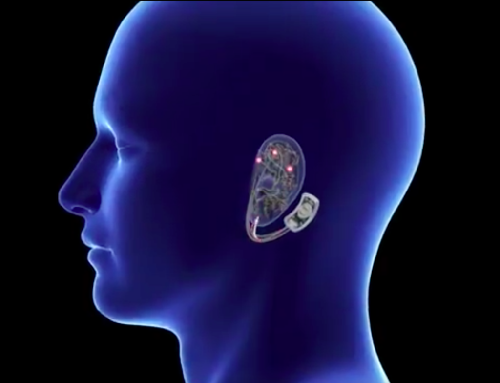 simulation of the bridge device