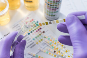 Proposed Unemployment Drug-Testing Rule Set To Be Finalized person testing a sample of urine