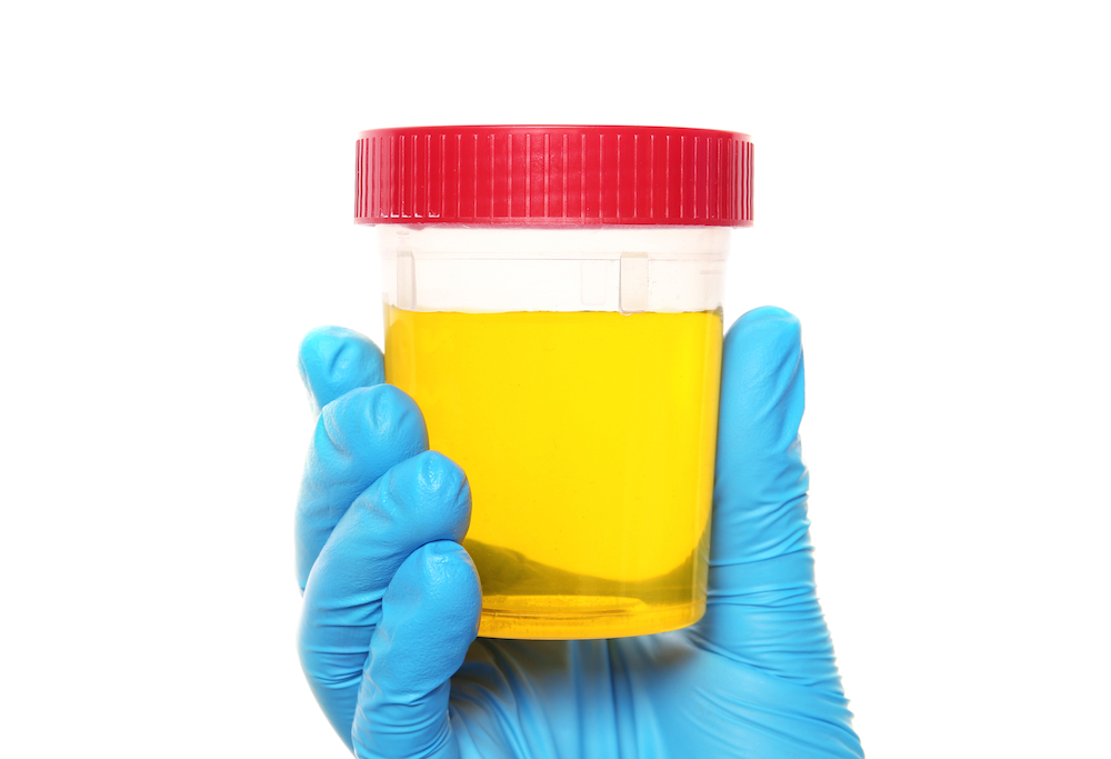 urine test insurance fraud