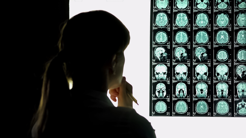 addiction researcher looking at brain scans